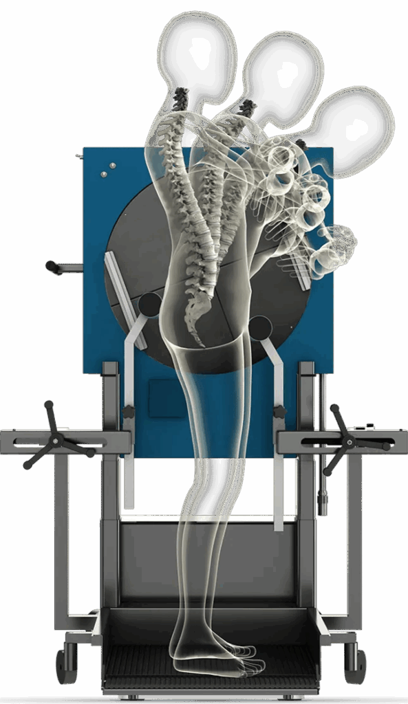 What is ligament laxity and how does it affect brain injuries? Learn more about cervical spine instability.